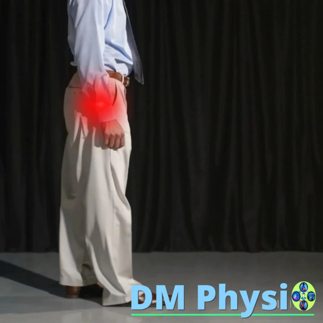 Анатомия при коксартроза